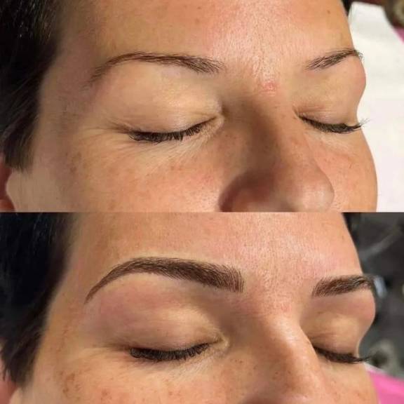 Brow Brow